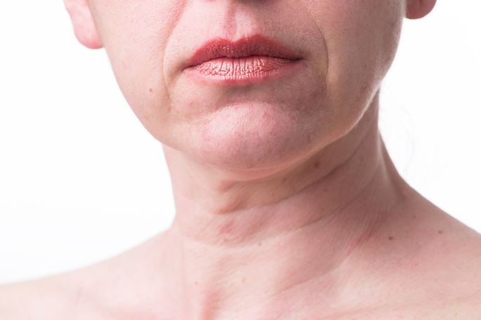 Furrowed lips of a mature woman.Signs of aging skin after 40. by Age less weigh less in Dover, NH