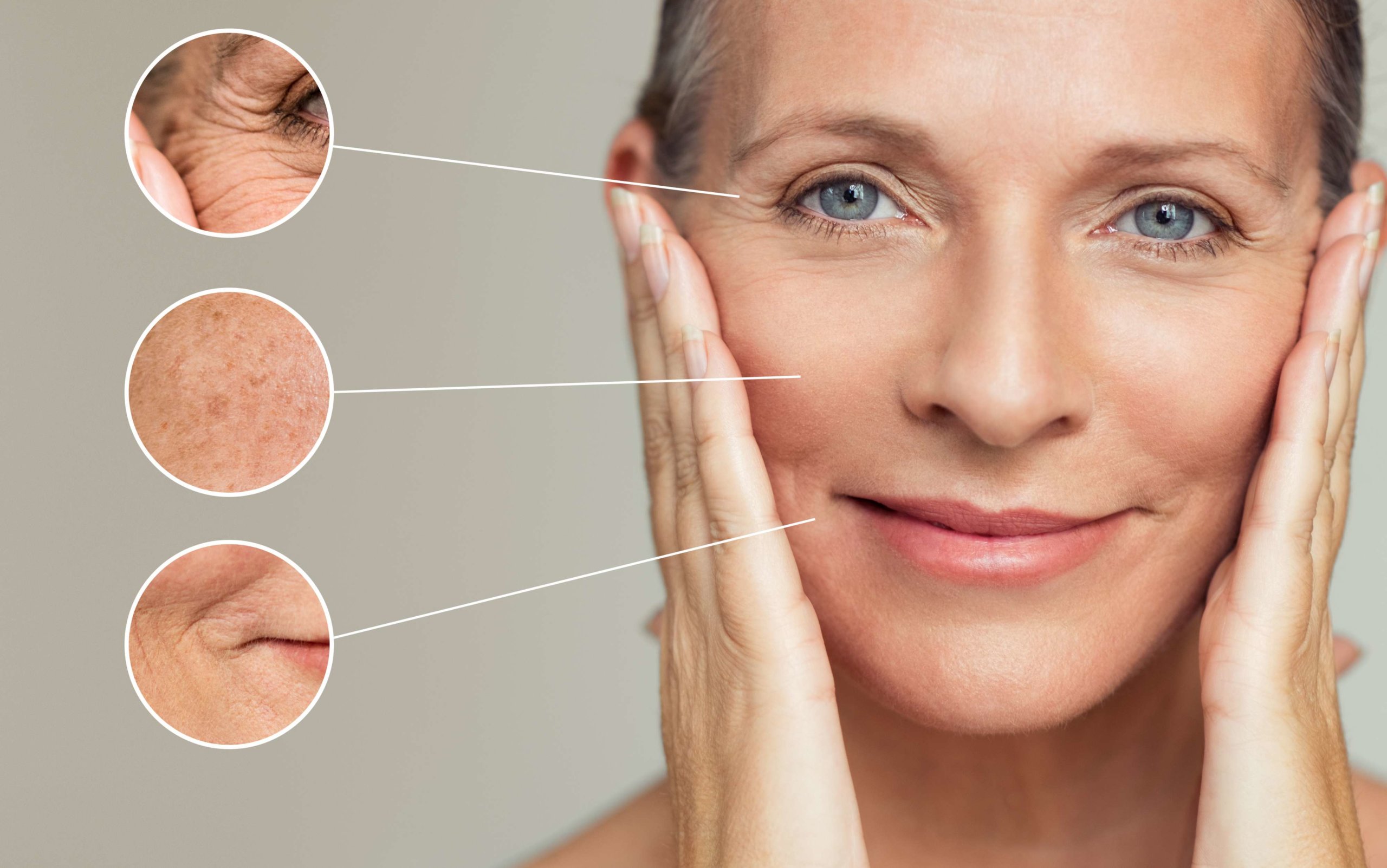 Botox For Nasolabial Folds | Woburn, MA & Dover, NH | Age less Weigh Less