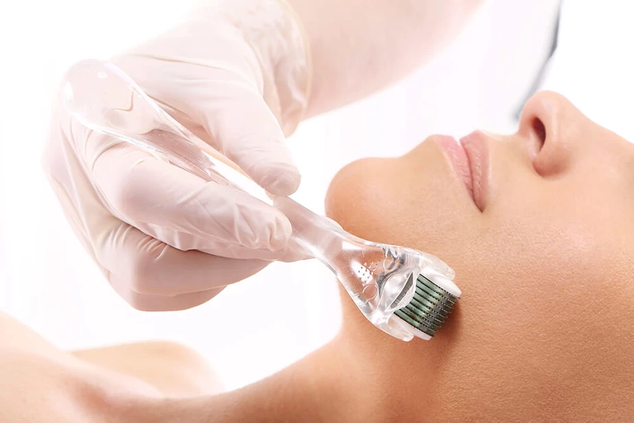 How Microneedling Works | Woburn, MA & Dover, NH | Age less Weigh Less